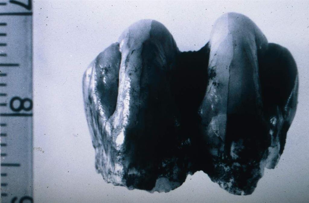 Cueva Victoria. Molar inferior de Theropithecus cf. oswaldi en vista labial (foto Bienvenido Martínez-Navarro)